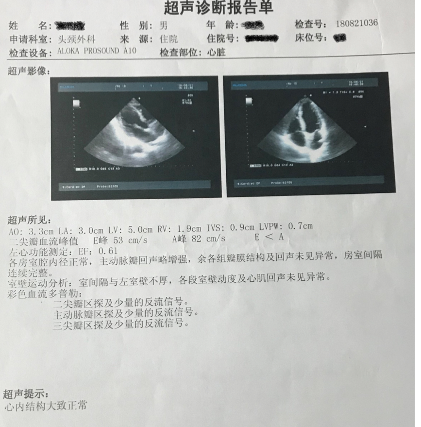 二,心脏彩超一些复杂先天性心脏病及特殊心血管综合征都有可能出现