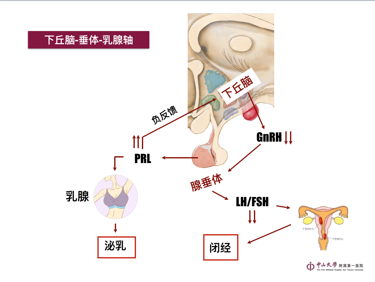 泌乳素瘤prl的药物和手术治疗