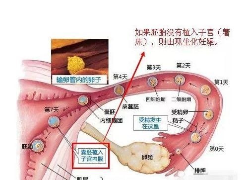 陽性,更不可能達到強陽;(2) 超聲看不到宮內有孕囊;(3) 血hcg值很低