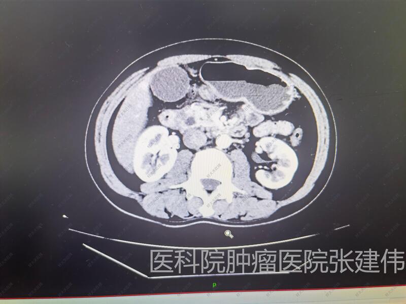圖文圖片