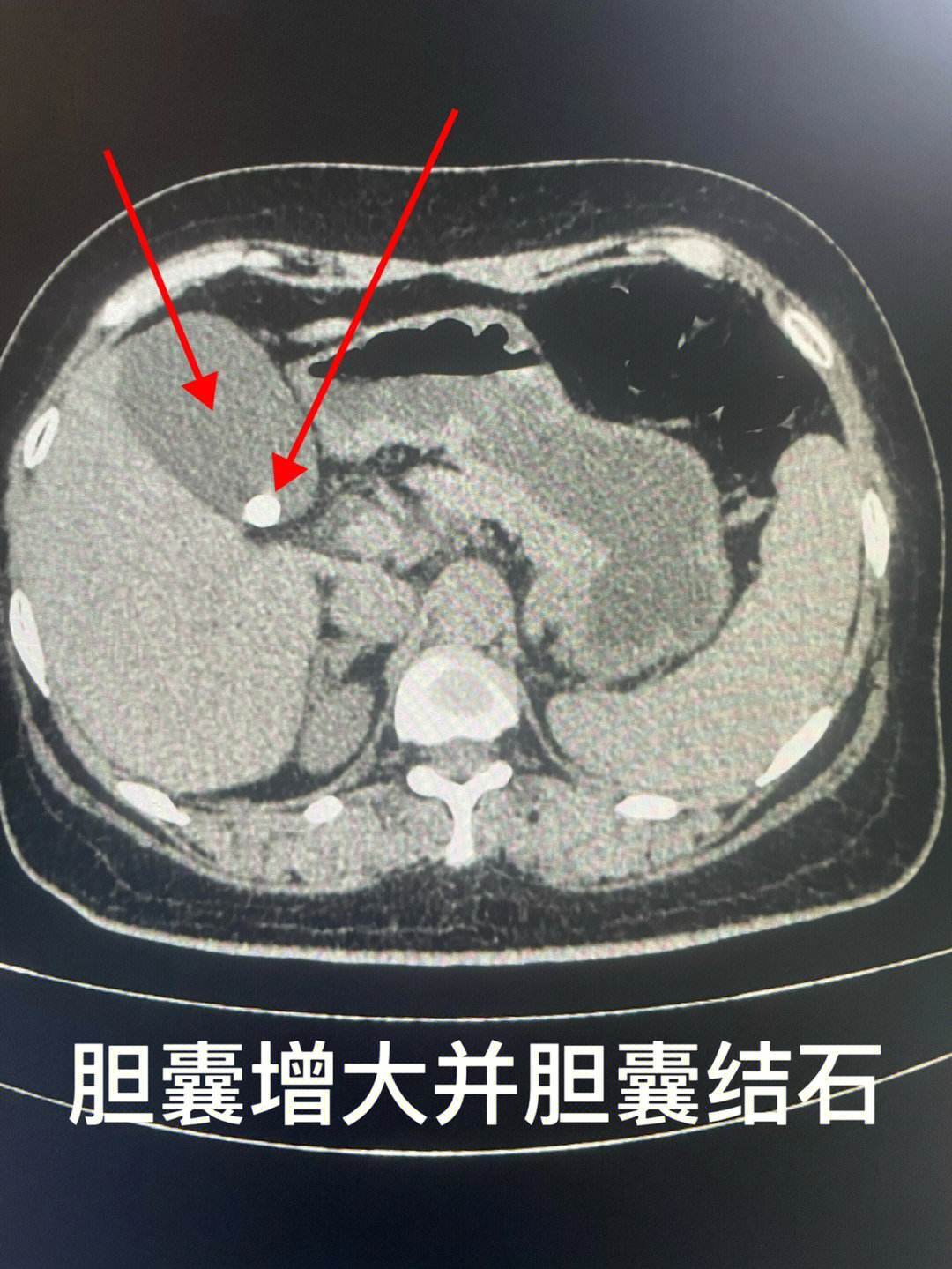 圖文圖片
