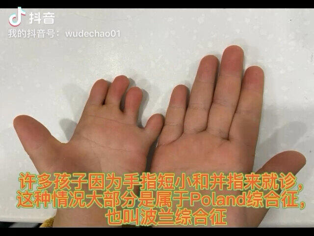 視頻封面