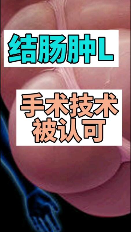 視頻封面