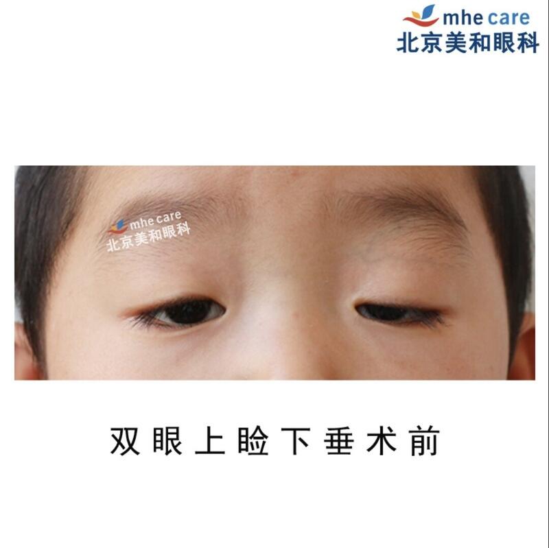 圖文圖片
