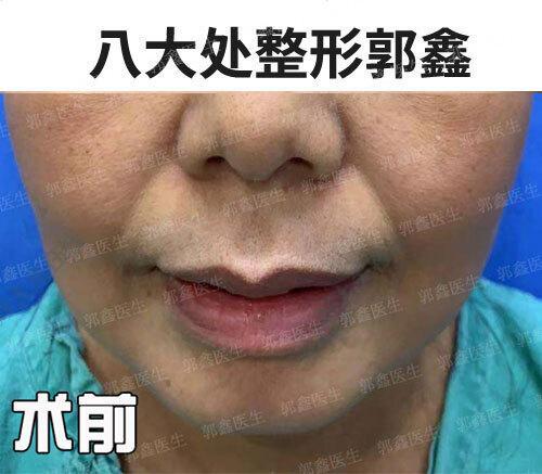图文图片