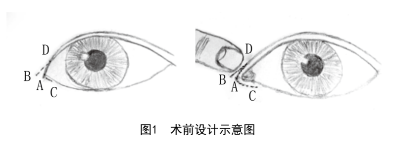 圖文圖片