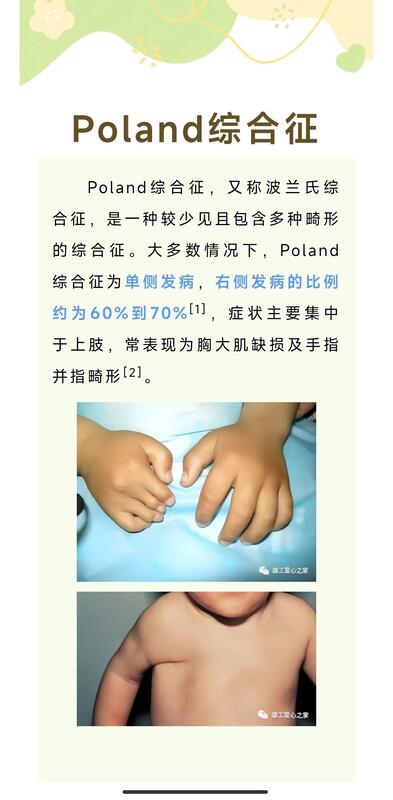 圖文圖片