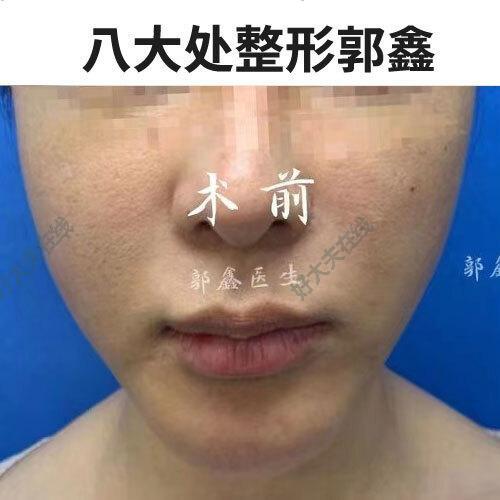 图文图片