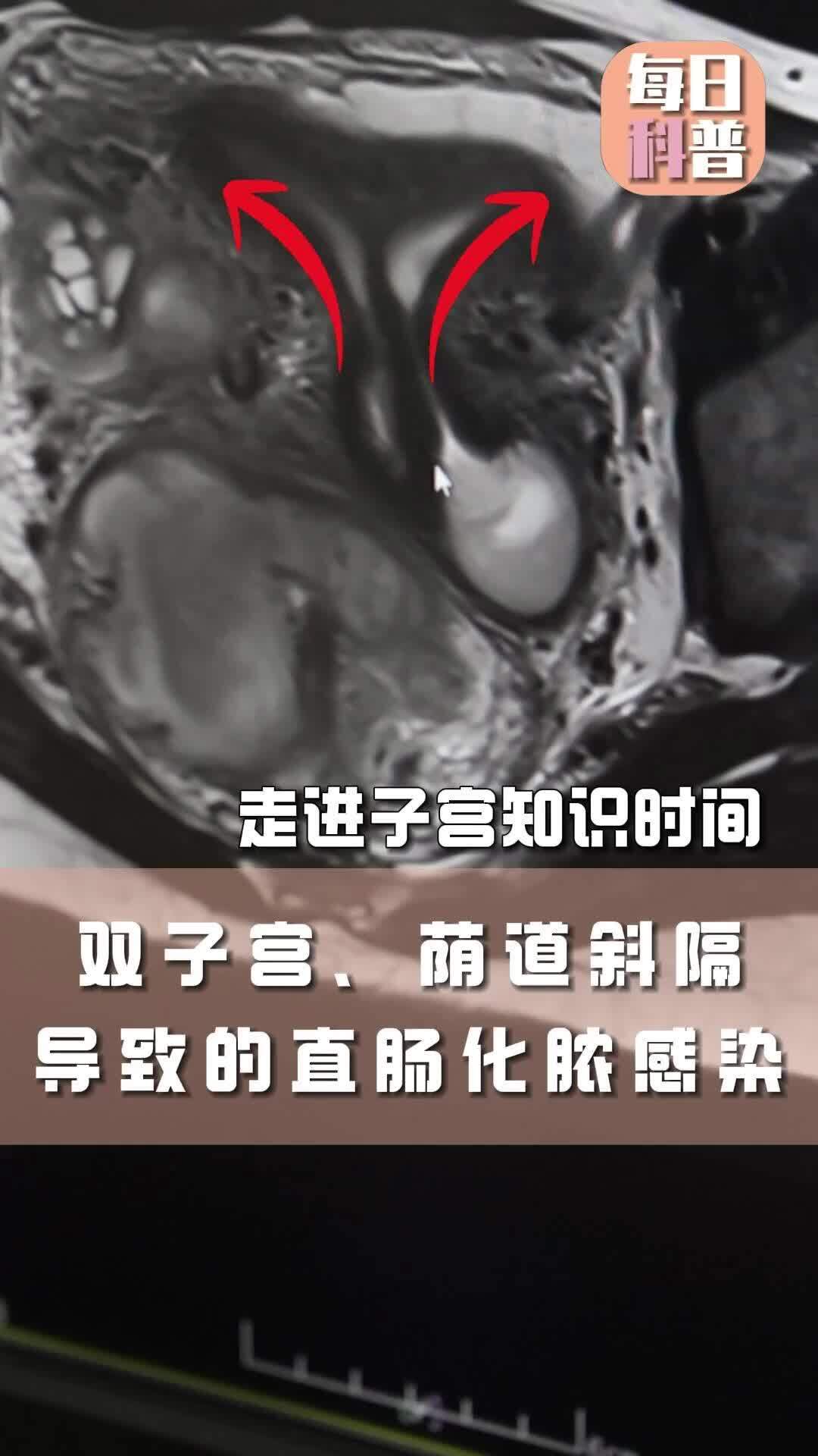 視頻封面