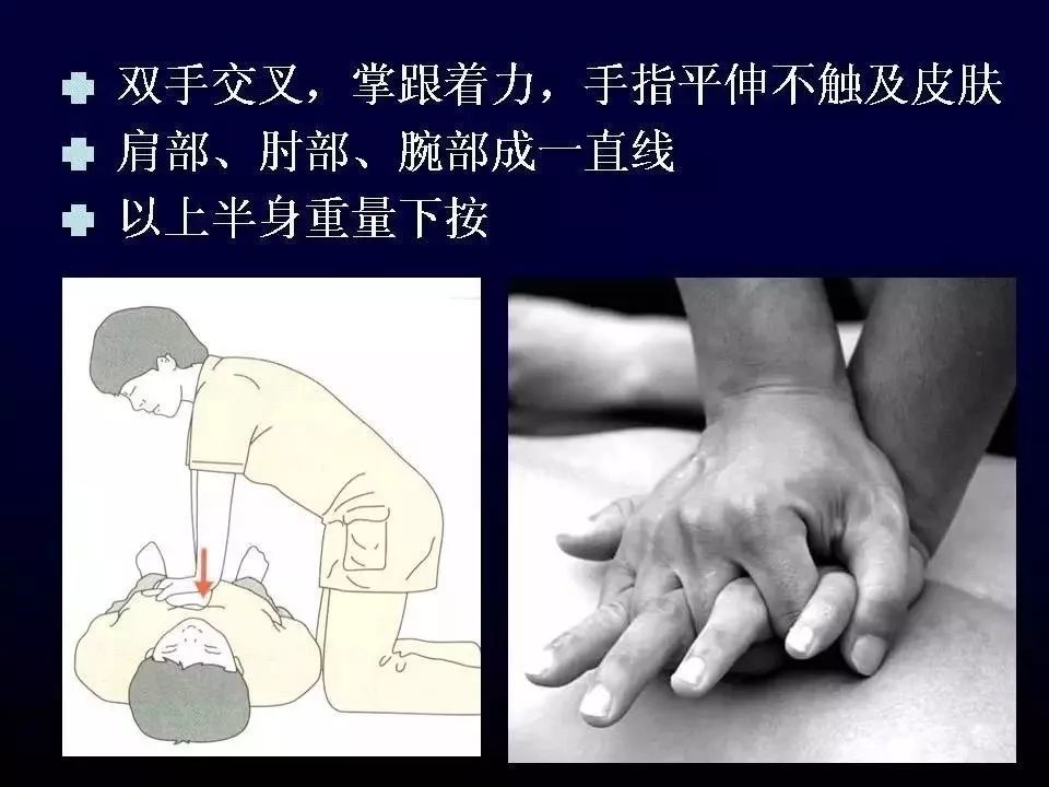 上帝之手心肺复苏你了解多少