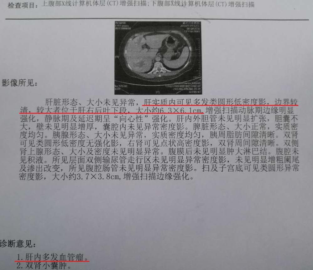 肝功好着能排除肝病吗_肝功能不好的症状?_肝功能是好的