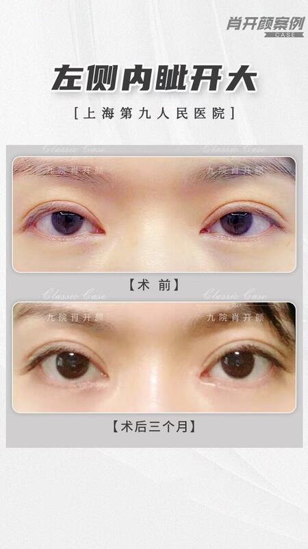 圖文圖片
