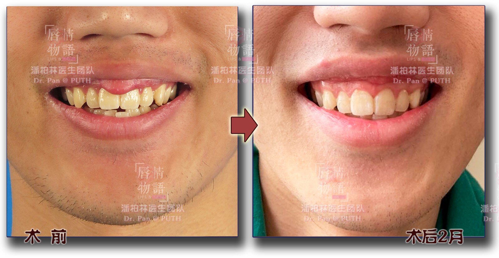 重唇 mip.haodf.com