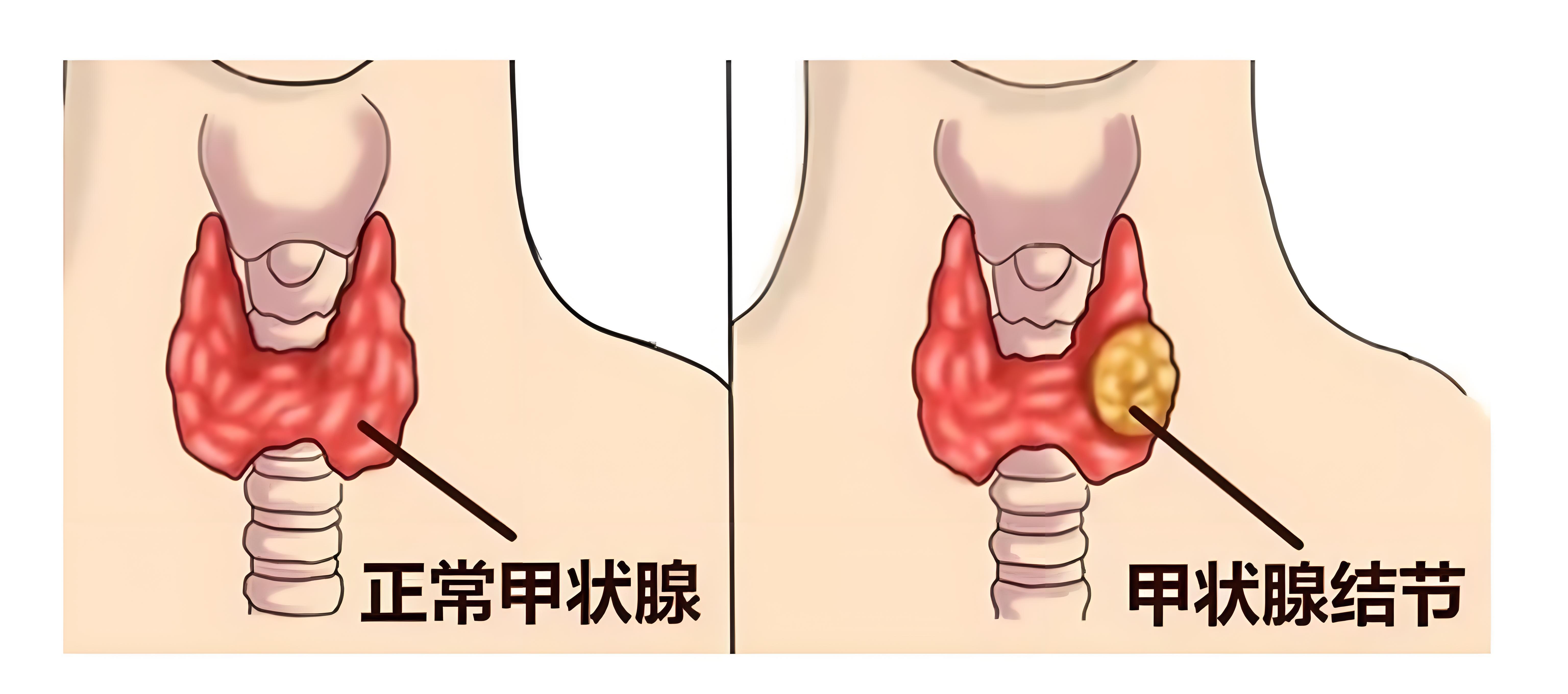 图文图片