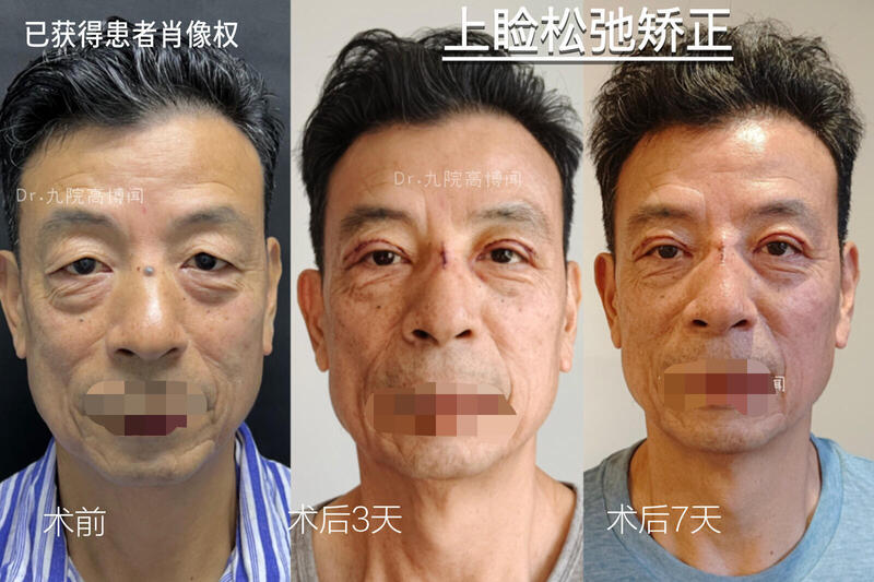 图文图片