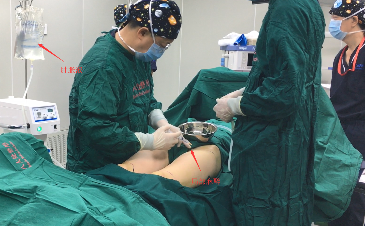 做吸脂手术|关于"吸脂手术"九大不为人知的误区,今日医生为你深入揭秘