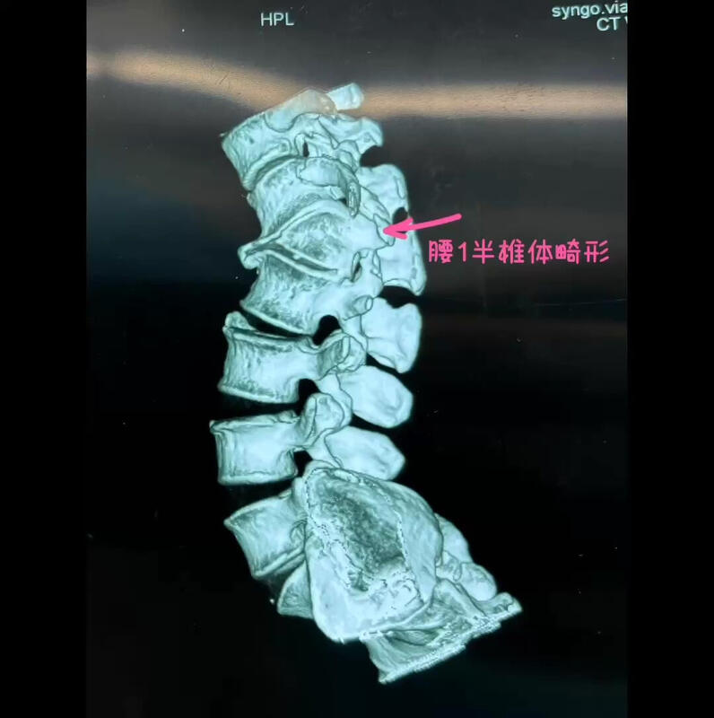 視頻封面