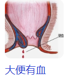 圖文圖片