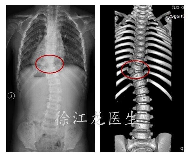 圖文圖片