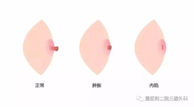 圖文圖片